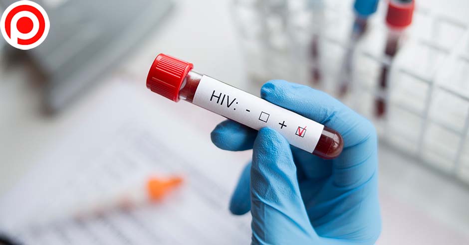 HIV