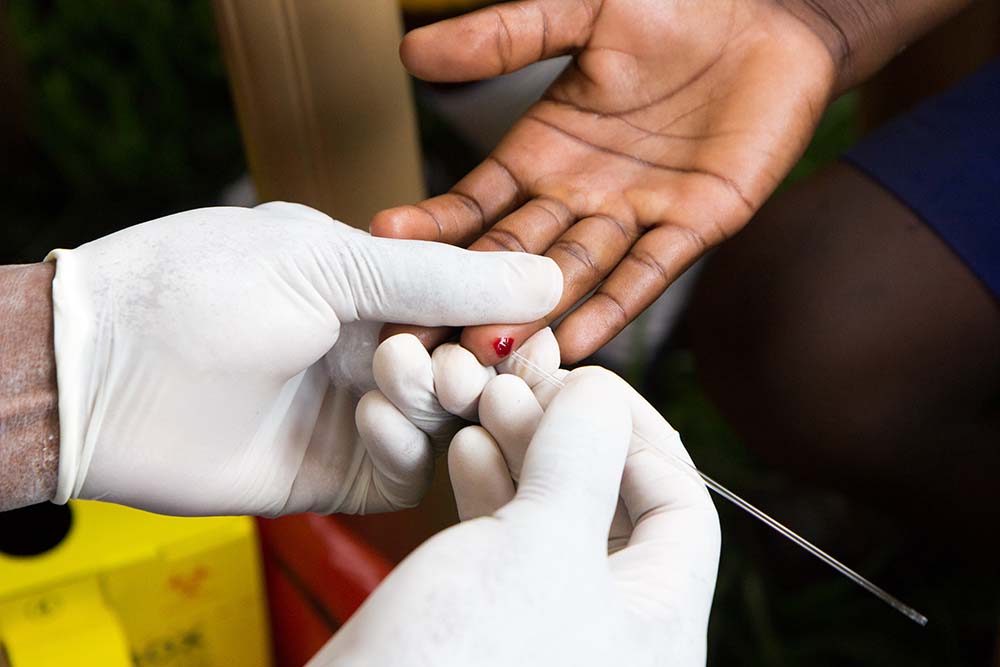 hiv02