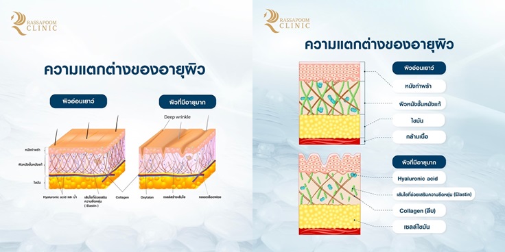 S__14278744-tile