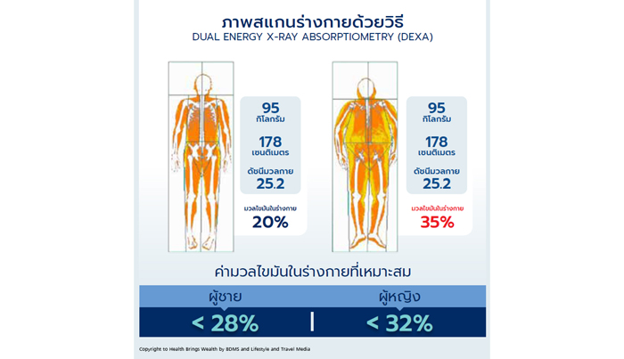 ภาพแสกน