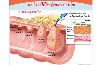 blogmedia-36778.jpg